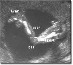 Gebelik Hamilelik Gebe Hamile Doğum Ultrason